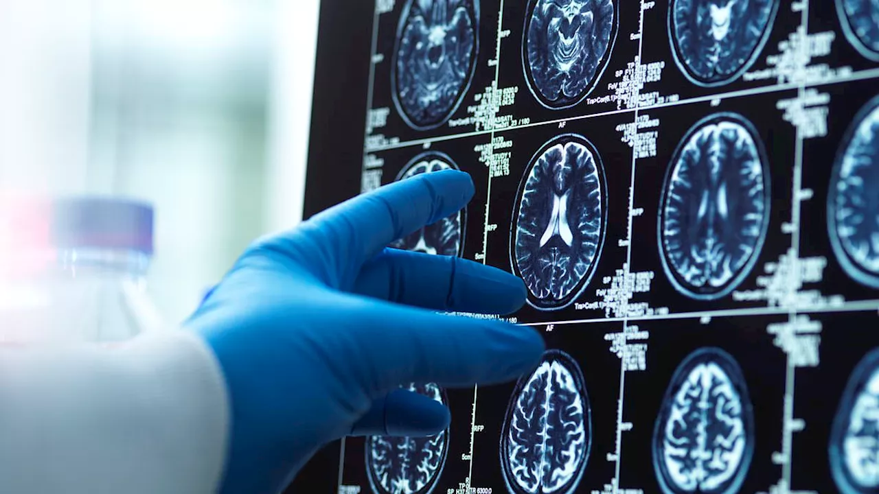 The Science of Terminal Lucidity: Why Minds Clear Before Death
