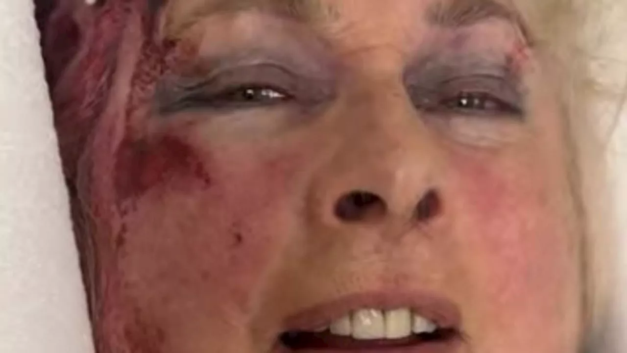 Resilience in the Face of MS: Jane Felstead’s Hospitalization and Recovery