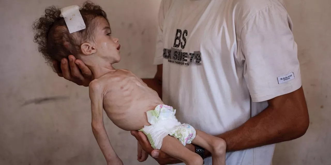 Gaza's Hollow Peace: The 1.2 Million Still Facing Severe Hunger