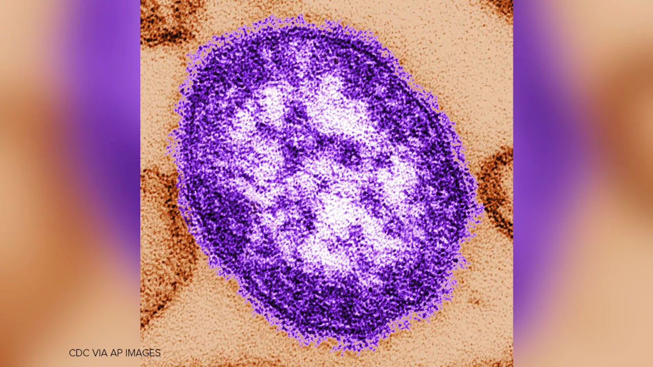 The 2026 Measles Surge: How Social Fragmentation Fuels a Public Health Crisis