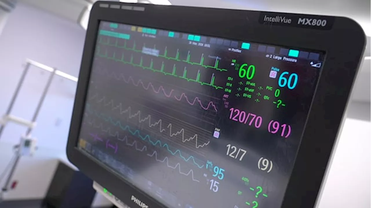 Beyond the Open Chest: Why Dr. Marc Ruel’s Study Could Redefine Bypass Surgery