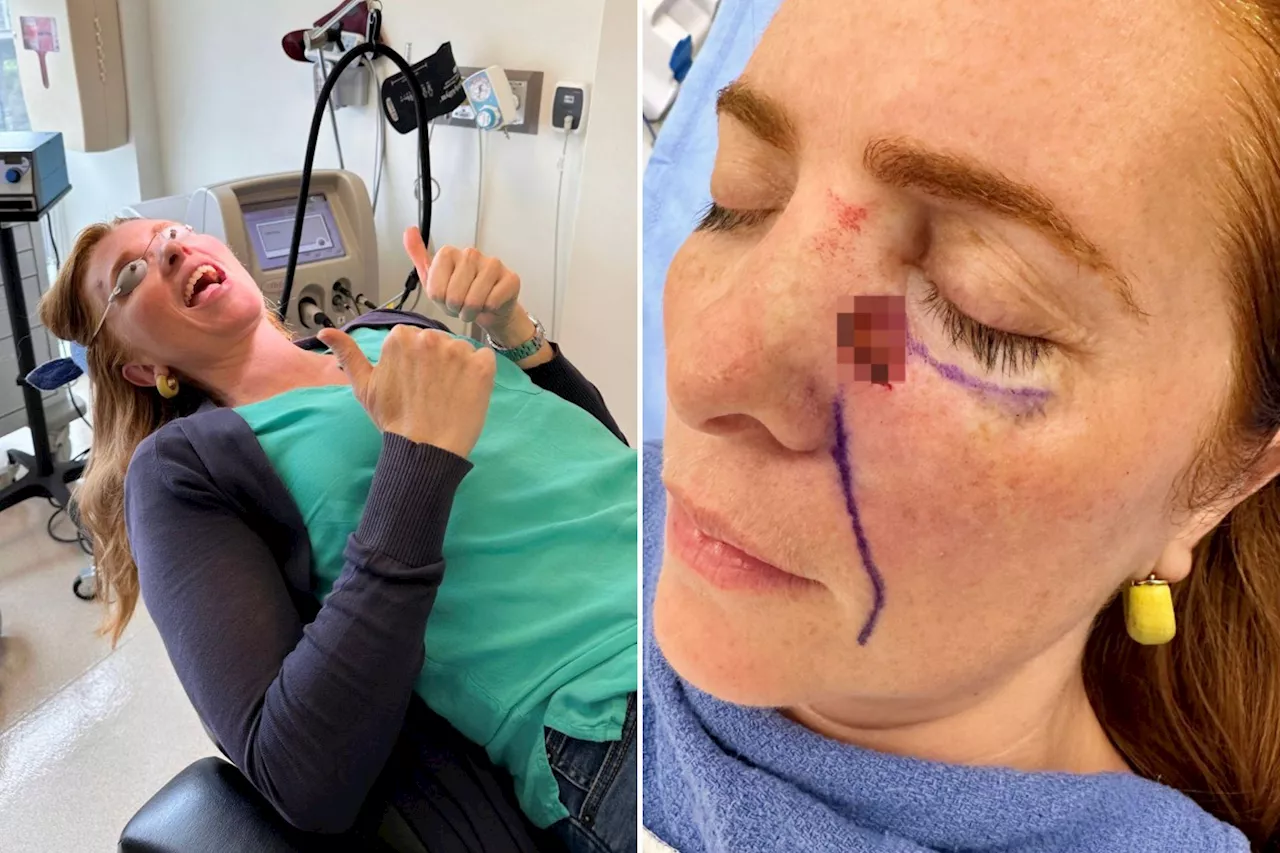 From Sunbeds to 60 Stitches: Anna Papalia’s Warning on Skin Cancer