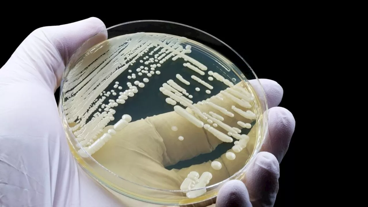 The Hair Follicle Bunker: How Cryptococcus neoformans Outsmarts the Immune System
