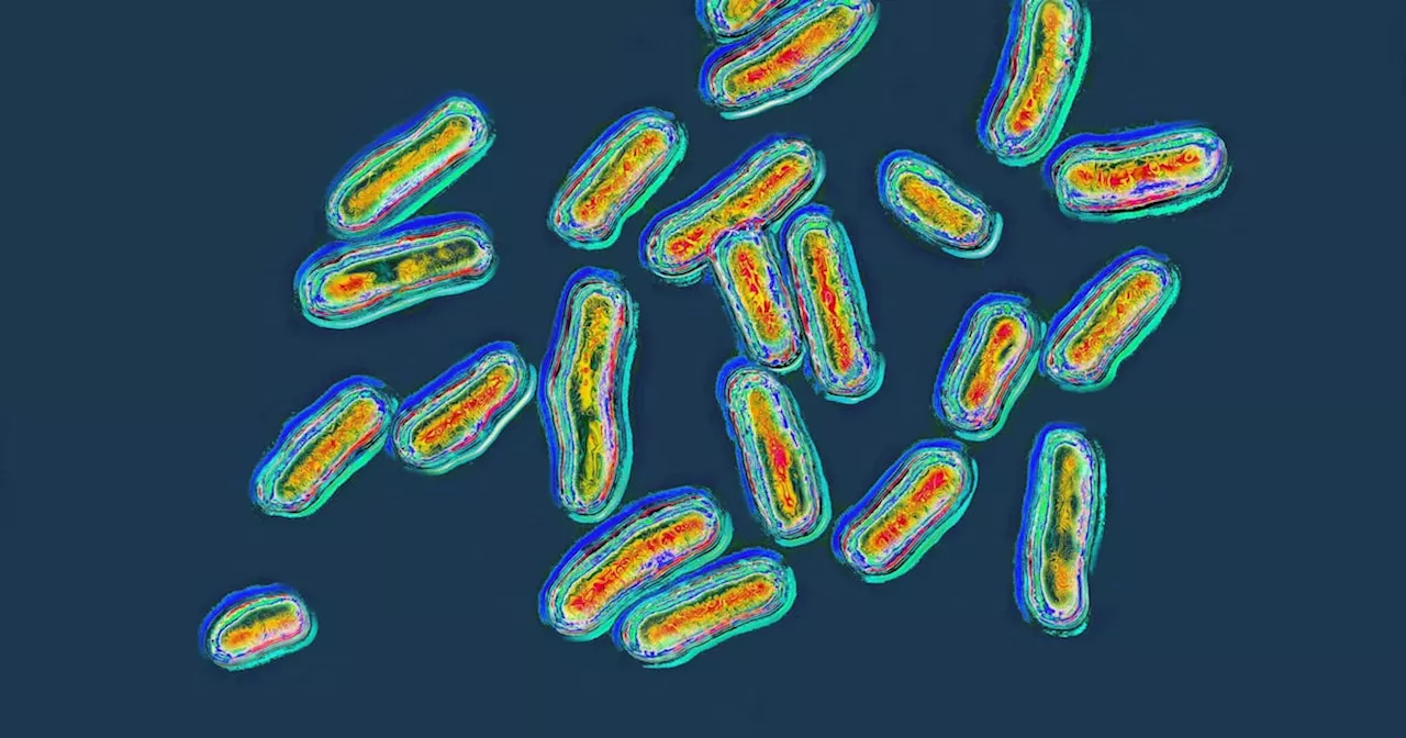 Salmonella Surge: Eggs, Peppers, and Pets Trigger Multiple U.S. Outbreaks