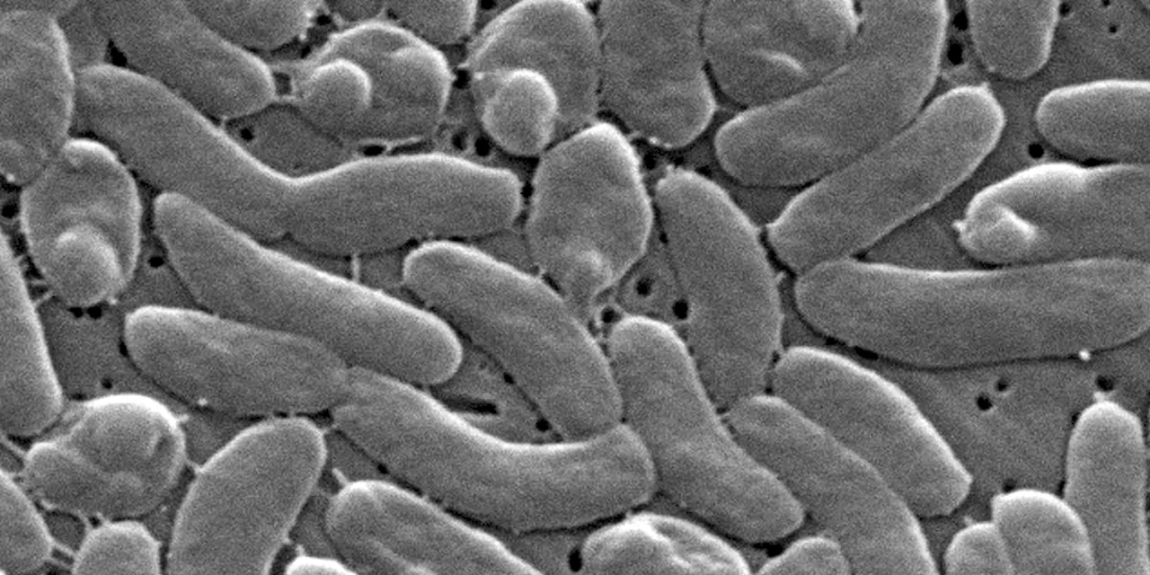 Louisiana's Deadly Summer: The Rising Threat of Vibrio vulnificus