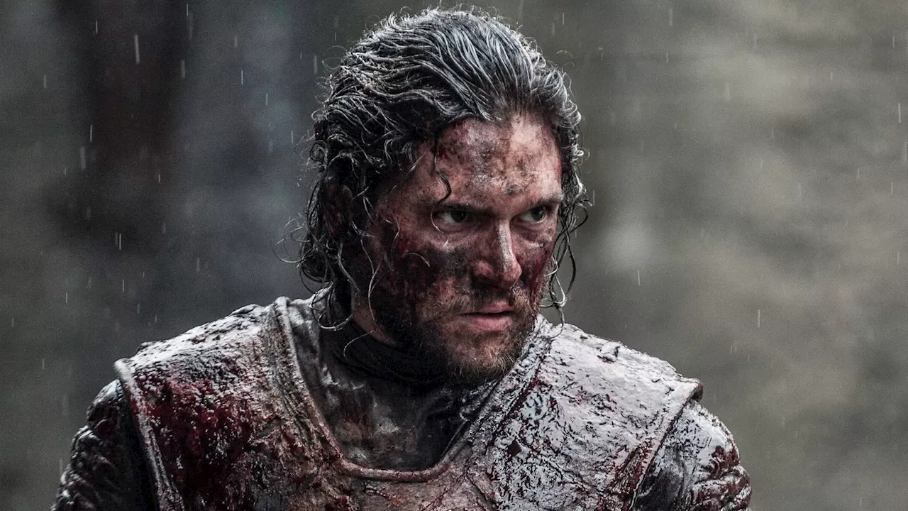 Kit Harington Swaps Westeros for the French Revolution in MGM+ Epic