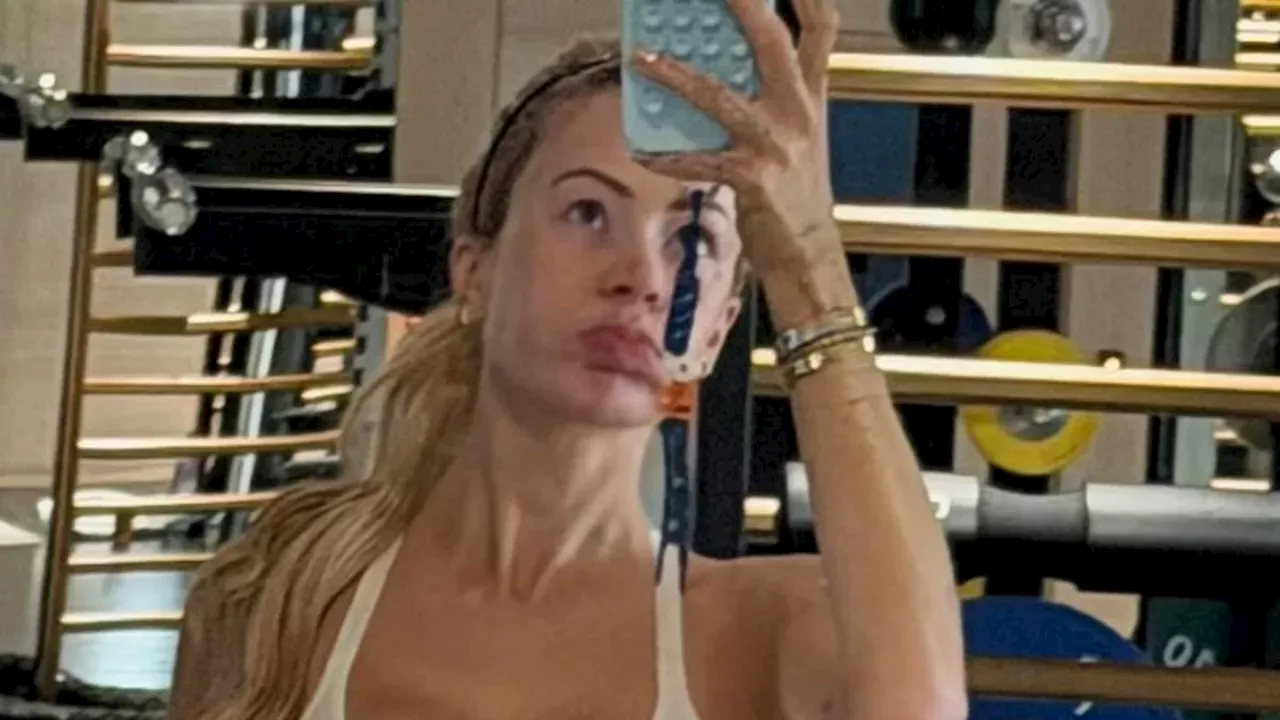 Olivia Attwood’s Wellness Pivot: Luxury, Cosmetic Debates, and Motherhood