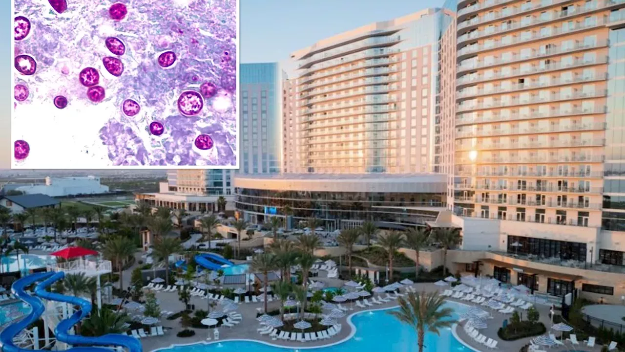 Chlorine-Resistant Parasite Hits Chula Vista's Gaylord Pacific Resort