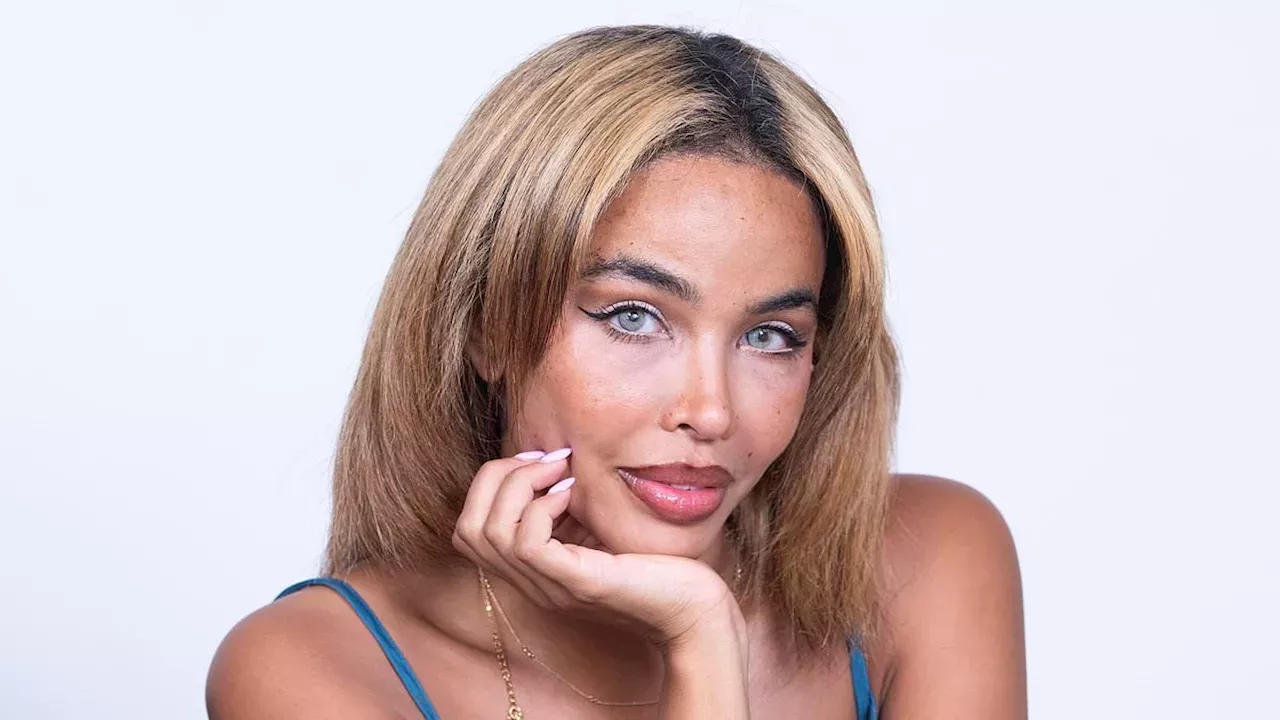 The 8cm Receding Hairline: The High Price of a Signature Ponytail