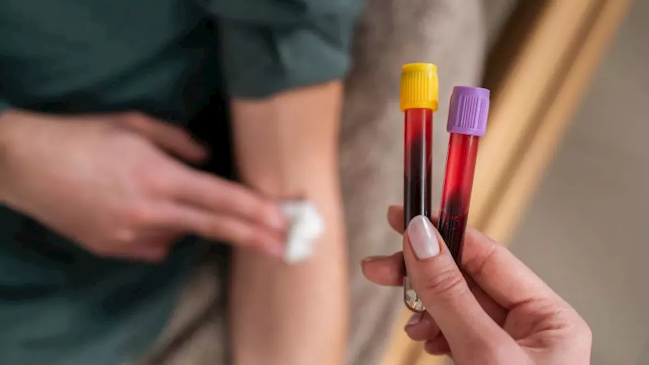 The AST and ALT Connection: New Clues in the Rise of Early-Onset Colorectal Cancer