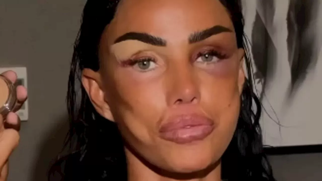 Beyond the Bruises: Katie Price Navigates NTA Red Carpet Amid Cosmetic and Personal Turmoil