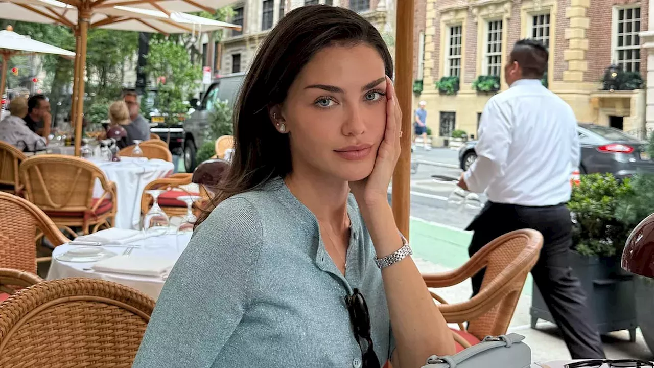 Model Shares Graphic Story of Allergic Reactions to Hair Dye and Urges Patch Testing