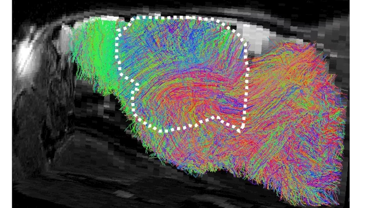 Stanford’s Human-Brain-Mice: A Neuroscience Leap or Ethical Minefield?