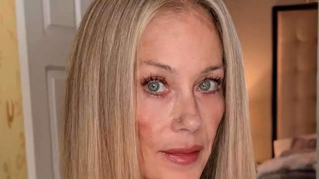 Beyond the Blonde: Christina Applegate’s Unfiltered Look at Life with MS
