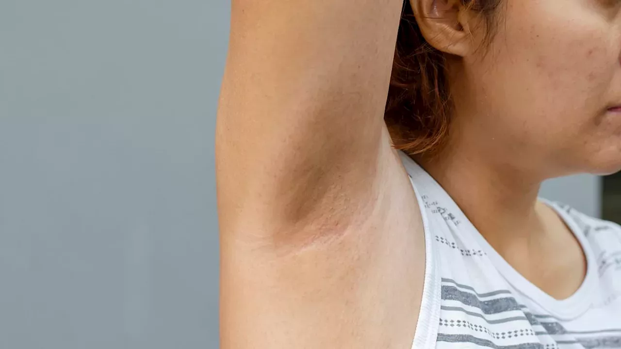 Skin Patches and Warfarin: Navigating Dr. Martin Scurr’s Medical Advice
