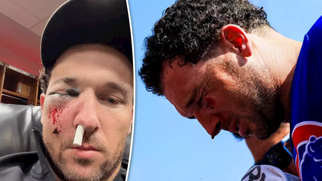 Cubs' Postseason Hopes Depend on Alex Bregman's Eye Recovery