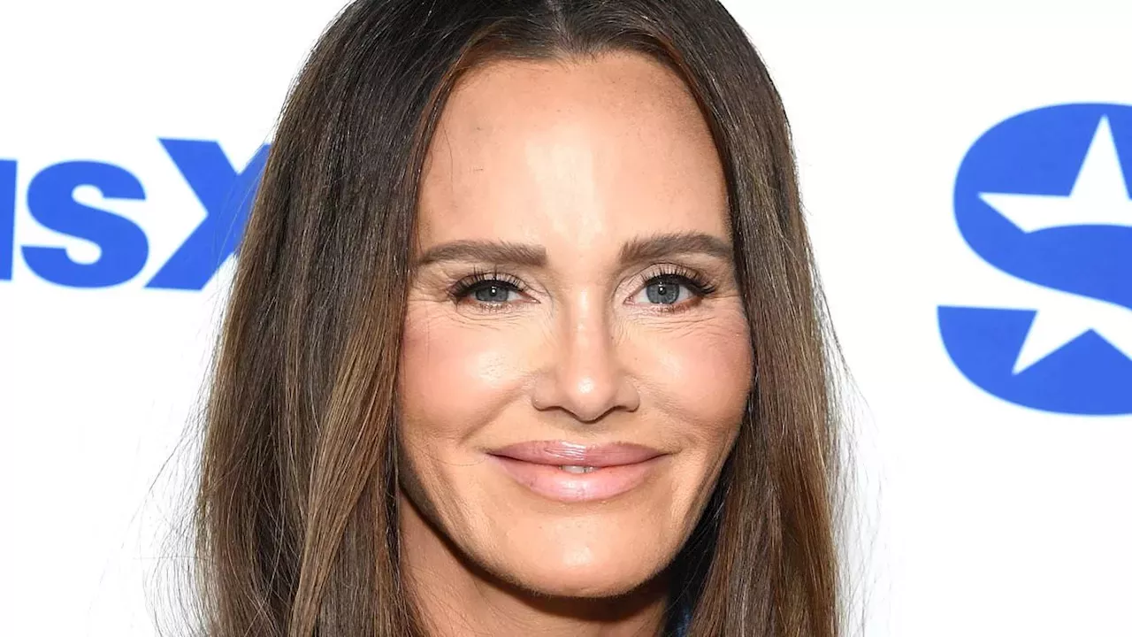 Meredith Marks’s Surgical Journey: From Secret Facelifts to Unexplained Medical Conditions