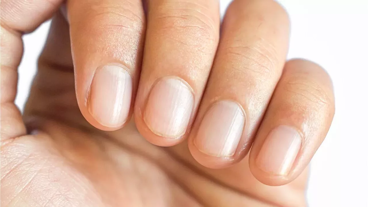 The Cosmetic Cost of GLP-1s: Nail Loss and Scalp Inflammation Linked to Weight-Loss Jabs