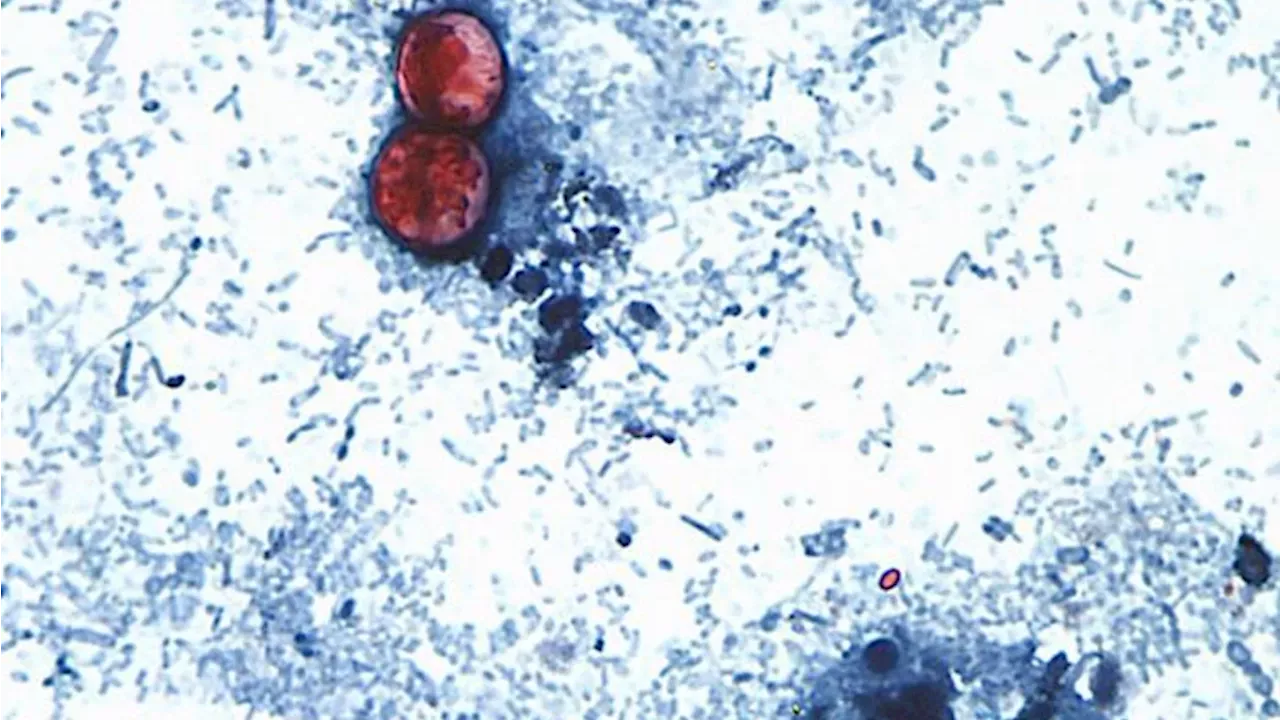 Parasite Outbreak: FDA Traces 13,000 Illnesses to Mexican Farm Wastewater