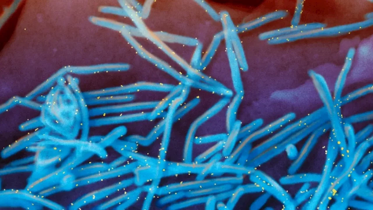Alberta's New RSV Shield: Free Antibody Treatments to Save Winter ICU Beds