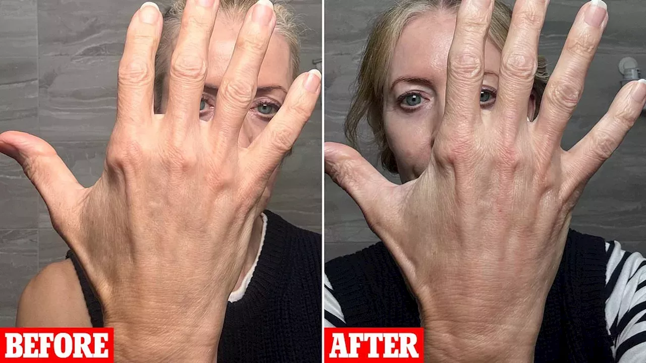 Can a £69 Serum Compete With a £1,200 Clinical Hand Rejuvenation?