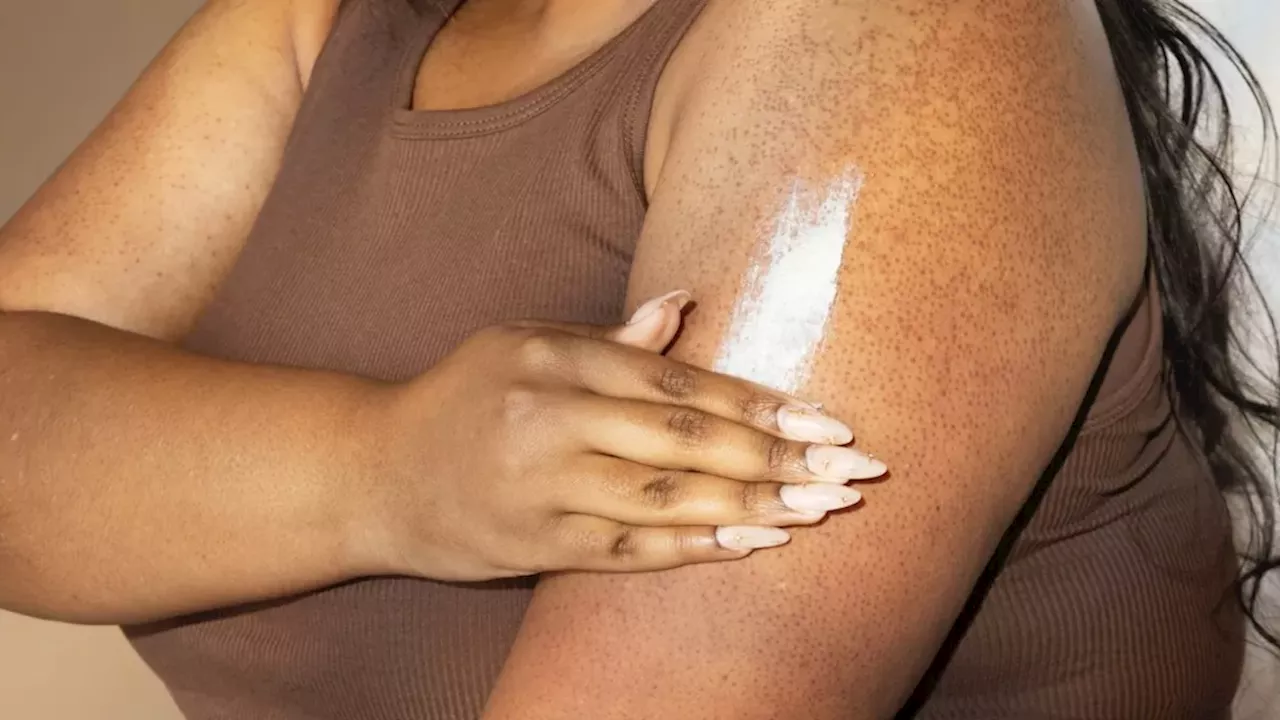 Managing the Bumps: A Deep Dive into Keratosis Pilaris Treatment