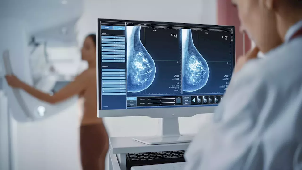 UK NHS Could Save £4m Annually by Expanding Prosigna Genetic Test to Low‑Risk Breast Cancer Patients