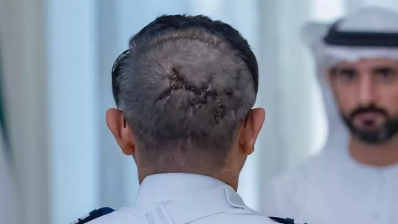 Pilot's Bravery Averts 'Israeli 9/11' After Co-Pilot's Axe Attack